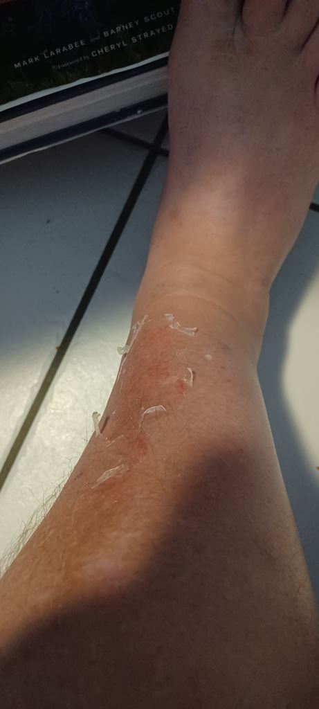 Sunscreen